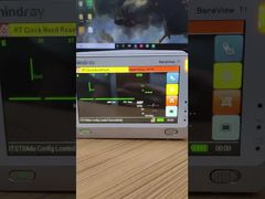 Vea por qué elegir la pantalla LCD del monitor de paciente Mindray BeneView T1 con cubierta frontal