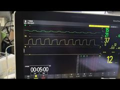 Vea la demostración del módulo Mindray AG y del módulo O2 MMS PN 115-023943-00